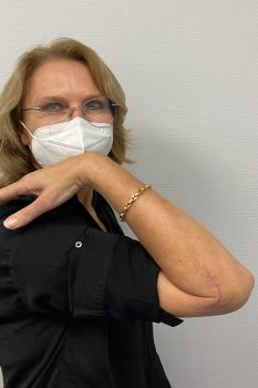 Bild Speichenköpfchenfraktur Gelenkstufenbildung Patientin hebt ihren Arm