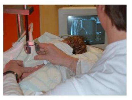 Bild Ultraschalluntersuchung einer Säuglingshüfte