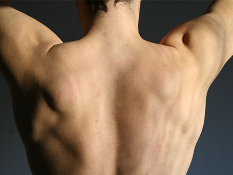 Bild von dem Rücken eines Patienten