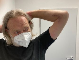Bild Patient verschränkt den Arm hinter dem Kopf